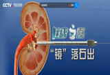  “镜”落石出